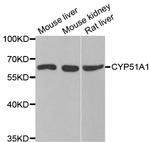 CYP51A1 Antibody in Western Blot (WB)