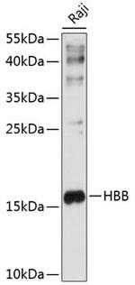 HBB Antibody in Western Blot (WB)