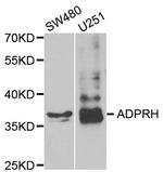 ADPRH Antibody in Western Blot (WB)