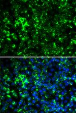 KV1.2 (KCNA2) Antibody in Immunocytochemistry (ICC/IF)