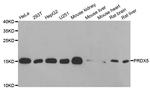 PRDX5 Antibody in Western Blot (WB)