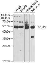 C4BPB Antibody in Western Blot (WB)