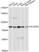 SLC26A2 Antibody in Western Blot (WB)