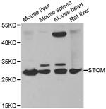 Stomatin Antibody in Western Blot (WB)