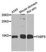 FABP5 Antibody in Western Blot (WB)