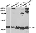 PCBD1 Antibody in Western Blot (WB)