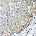 PPOX Antibody in Immunohistochemistry (Paraffin) (IHC (P))