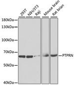 PTPRN Antibody in Western Blot (WB)