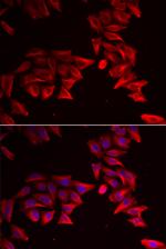 SFRP4 Antibody in Immunocytochemistry (ICC/IF)