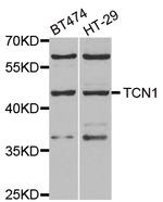 TCN1 Antibody in Western Blot (WB)