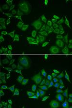 C1D Antibody in Immunocytochemistry (ICC/IF)