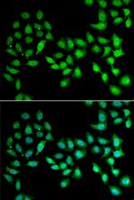 UCN2 Antibody in Immunocytochemistry (ICC/IF)