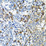 HYOU1 Antibody in Immunohistochemistry (Paraffin) (IHC (P))