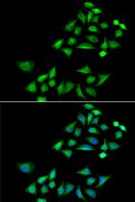 Kallikrein 4 Antibody in Immunocytochemistry (ICC/IF)