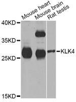 Kallikrein 4 Antibody in Western Blot (WB)