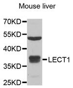 LECT1 Antibody in Western Blot (WB)