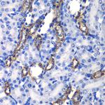 MATK Antibody in Immunohistochemistry (Paraffin) (IHC (P))