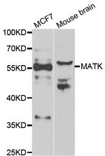 MATK Antibody in Western Blot (WB)