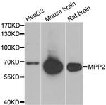 MPP2 Antibody in Western Blot (WB)