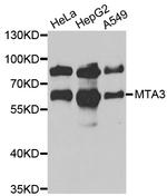 MTA3 Antibody in Western Blot (WB)