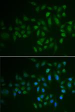 MLCK Antibody in Immunocytochemistry (ICC/IF)