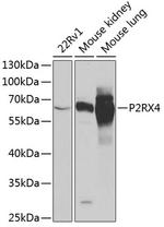 P2X4 Antibody in Western Blot (WB)