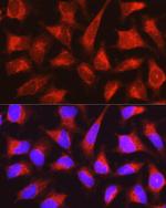 PYGL Antibody in Immunocytochemistry (ICC/IF)