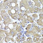 PYGL Antibody in Immunohistochemistry (Paraffin) (IHC (P))