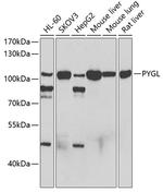 PYGL Antibody in Western Blot (WB)