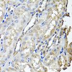 SCYL1 Antibody in Immunohistochemistry (Paraffin) (IHC (P))