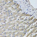 SCYL1 Antibody in Immunohistochemistry (Paraffin) (IHC (P))