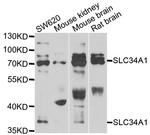 SLC34A1 Antibody in Western Blot (WB)