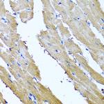 Sorcin Antibody in Immunohistochemistry (Paraffin) (IHC (P))