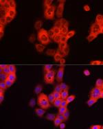 TDO2 Antibody in Immunocytochemistry (ICC/IF)