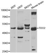 TDO2 Antibody in Western Blot (WB)