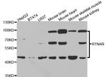 Nogo Receptor Antibody in Western Blot (WB)