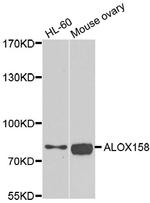 ALOX15B Antibody in Western Blot (WB)