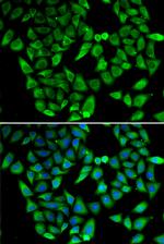 ASIP Antibody in Immunocytochemistry (ICC/IF)