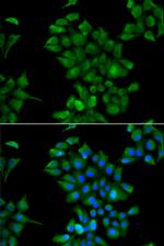 CTNS Antibody in Immunocytochemistry (ICC/IF)