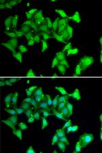 MYO1C Antibody in Immunocytochemistry (ICC/IF)