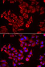 Serglycin Antibody in Immunocytochemistry (ICC/IF)