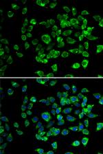 PSMD13 Antibody in Immunocytochemistry (ICC/IF)