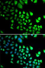 RBBP5 Antibody in Immunocytochemistry (ICC/IF)