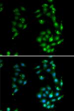 SOX5 Antibody in Immunocytochemistry (ICC/IF)