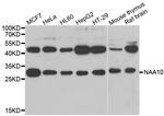 ARD1A Antibody in Western Blot (WB)