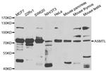 ASMTL Antibody in Western Blot (WB)