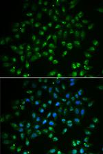 HAND2 Antibody in Immunocytochemistry (ICC/IF)