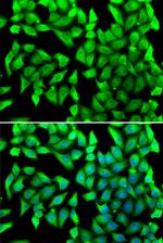 VTI1B Antibody in Immunocytochemistry (ICC/IF)