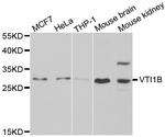 VTI1B Antibody in Western Blot (WB)