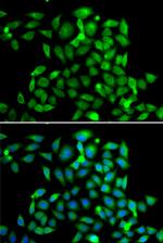 CLASP1 Antibody in Immunocytochemistry (ICC/IF)